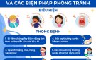 BÀI TRUYỀN THÔNG: Phòng, chống bệnh bạch hầu   